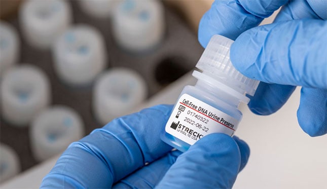 Cell-Free DNA Urine Preserve