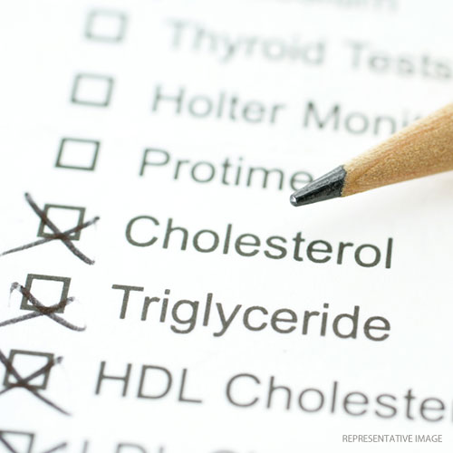 Cholesterol Standard