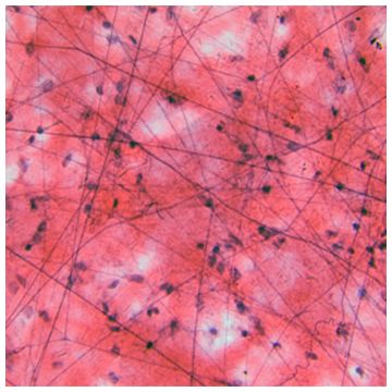 Collagen Type I-A Acid soluble gel forming Cellmatrix&#174; 3mg/ml pH 3.0 porcine tendon 100ml Nitta Gelatin Wako