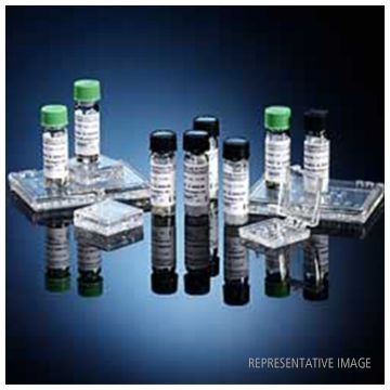 Aspergillus Control Sera for Complement Fixation Test (CF) Reagents Immy  1ml