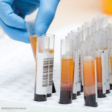 Cholesterol reagent for quantitative in vitro determination in human serum or plasma 0.08 – 19.4 mmol/L CHOD-PAP method Dialab